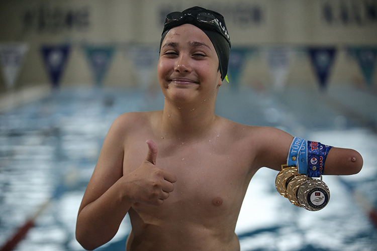 Tek Koluyla Yüzen Muhammed Ali Ilk Madalyalarını Aldı3