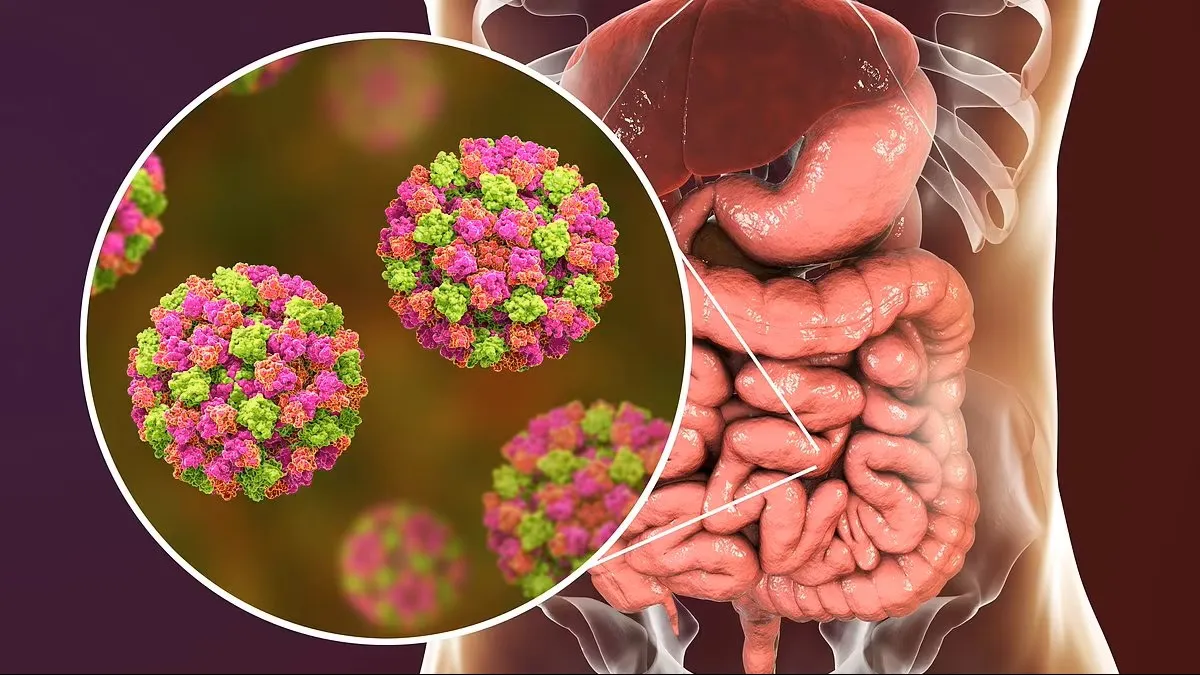 Vakalar Artıyor Kaburga Kıran Hastalık Olarak Biliniyor1