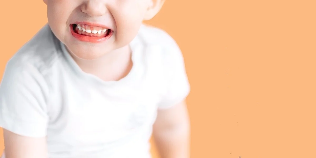 2–5 Yaş Arası Çocuklarda Uykuda Diş Gıcırdatma1