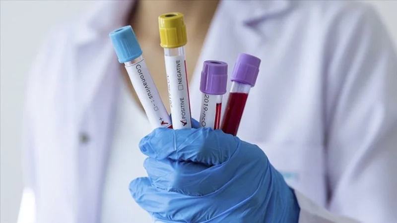 Covid 19 Salgınının Üzerinden 6 Yıl Geçti2