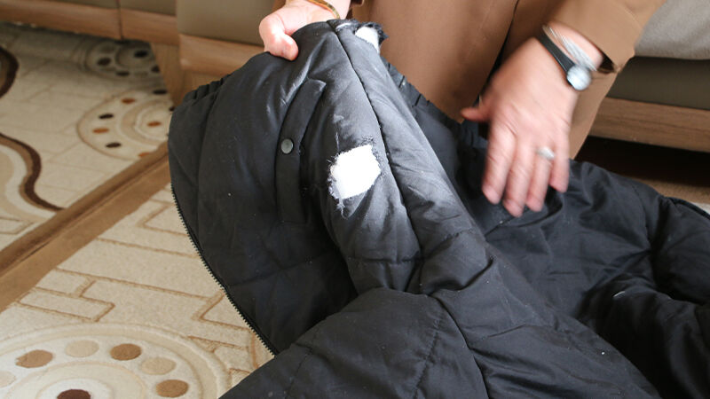 Kütahya'da Köpeklerin Saldırdığı 9 Yaşındaki Çocuk Yaralandı (3)