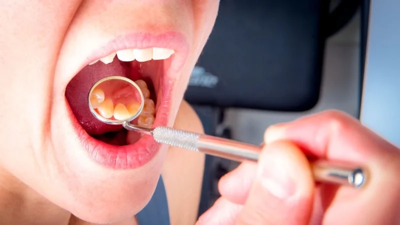 Damak Şişmesine Yol Açan Hatalara Dikkat