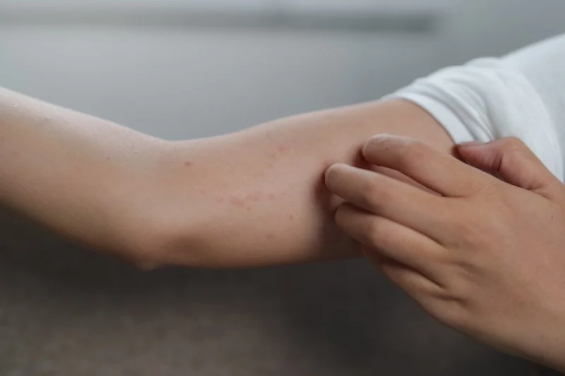 Kollardaki Pütürlü Doku Ne Anlatıyor2