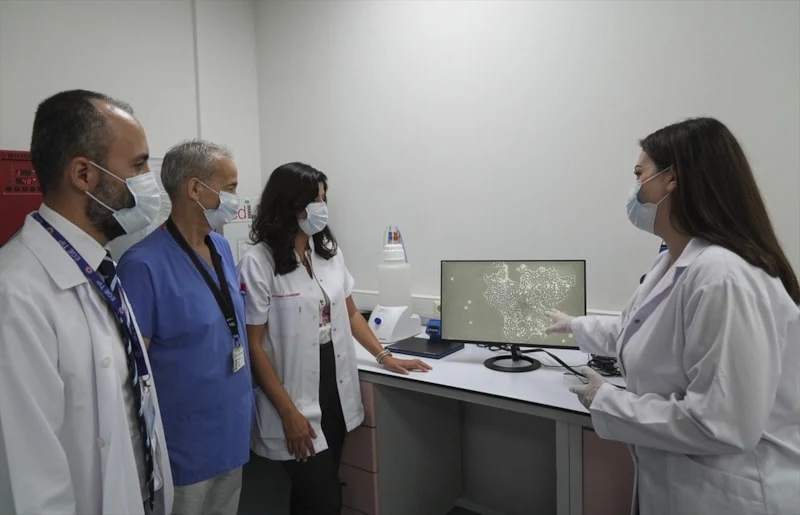 Diş Kök Hücreleri Çikolata Kisti Tedavisine Umut Oldu3