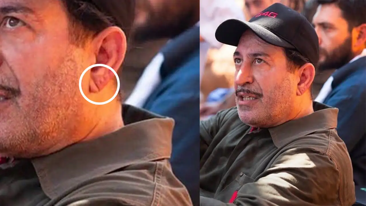 Kulaktaki Bu Çizgiye Dikkat2