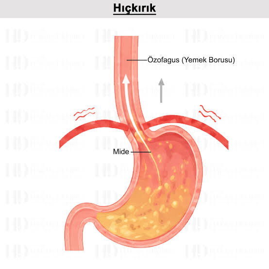 Hıçkırık Neden Olur? Hıçkırık Nasıl Geçer?