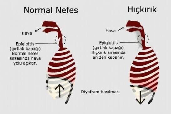 Hıçkırık Neden Olur? Hıçkırık Nasıl Geçer?1