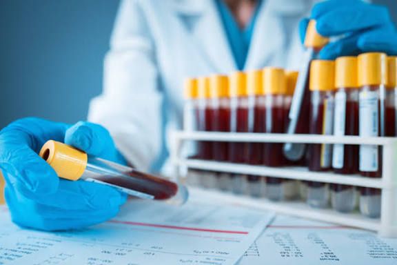 Kanser Tedavisinde Yeni Dönem Genetik Testler Öne Çıkıyor4